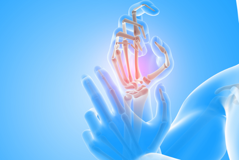 Arthritis Treatment in East Delhi